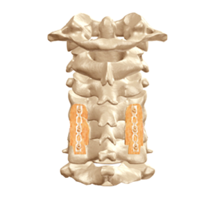 Posterior-Cervical-Fusion